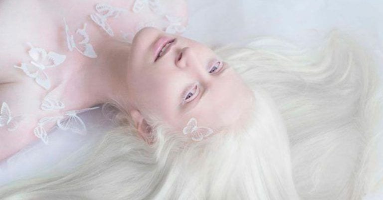 Una artista refleja la belleza inconmensurable de los albinos, perseguidos en muchos lugares