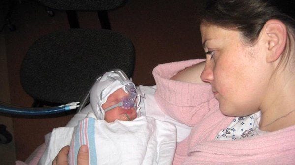 bebes prematuros7