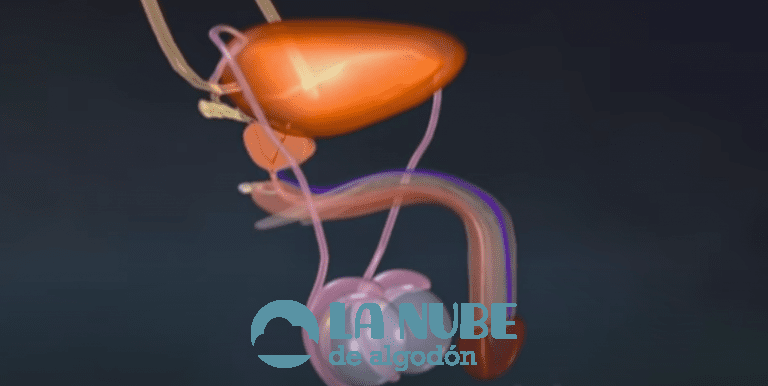 Cáncer de próstata, Causas y Tratamiento